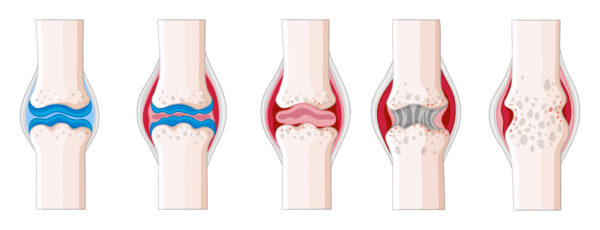 Calcium with Vitamin D - Image 2